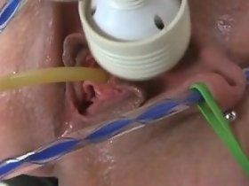 Catheter insertion be proper of himself
